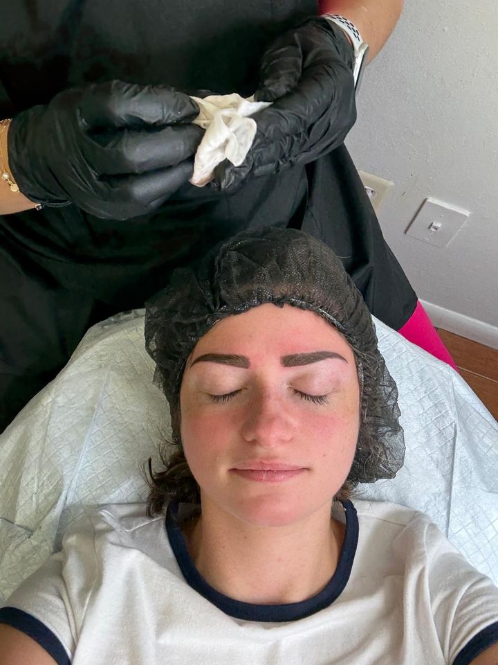 Brow and skin treatment in progress